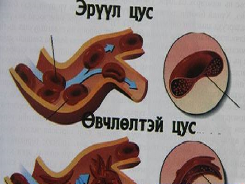 Цусны өвчин илрэх шинж тэмдэг, бусад нөлөөлөл